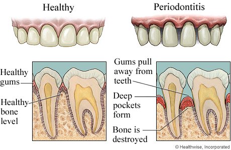 Periodontist in San Antonio